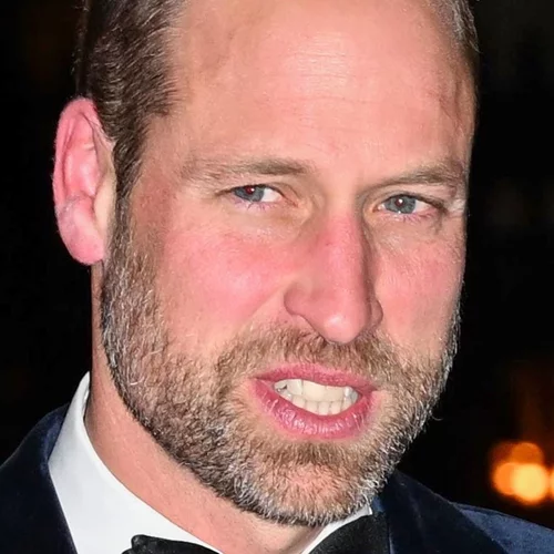 Πρίγκιπας William | Η νέα του εικόνα προκαλεί ανησυχία