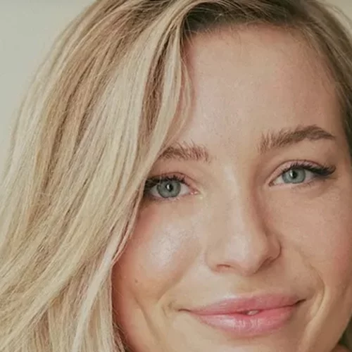 Οι καλύτερες τροφές που μειώνουν τις ρυτίδες