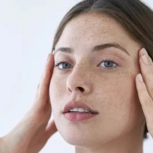 5 κρέμες με SPF που δρουν κατά των καφέ κηλίδων στο πρόσωπο