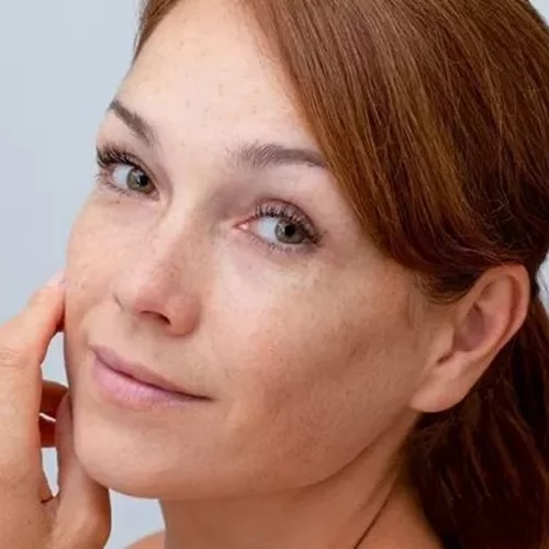 5 κρέμες που διορθώνουν τις καφέ κηλίδες και τα σημάδια