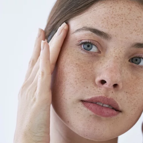 5 τοπικές θεραπείες που "φωτίζουν" αμέσα τις καφέ κηλίδες