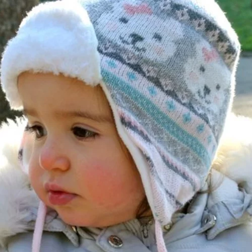 Γιατί το μωρό έχει κόκκινα μάγουλα; Οι πιθανές αιτίες και πότε να ανησυχήσεις