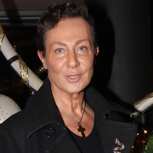 Βασίλειος Κωστέτσος | Πώς έφτασε να κάνει εγχείρηση ανοιχτής καρδιάς, μετά από μεταμόσχευση μαλλιών