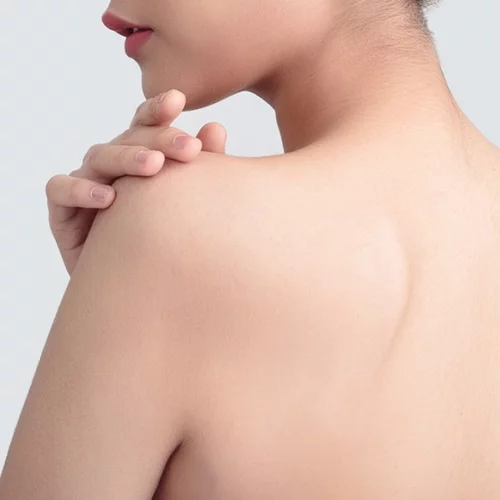 Σπυράκια στο σώμα | Από τι προκαλούνται και πώς αντιμετωπίζονται;