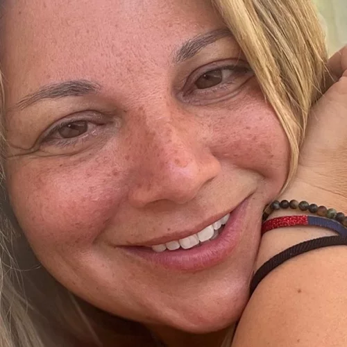 Χωρίς Φίλτρα | 8 Ελληνίδες celebrities που δείχνουν περήφανα τα "ψεγάδια" της επιδερμίδας τους