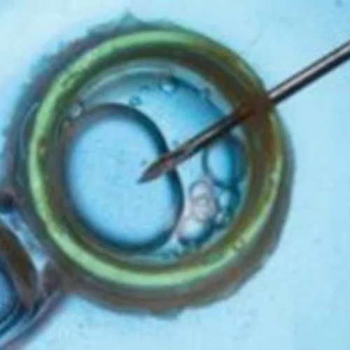 ΠΟΥ: Ένας στους έξι ανθρώπους παγκοσμίως εμφανίζει υπογονιμότητα