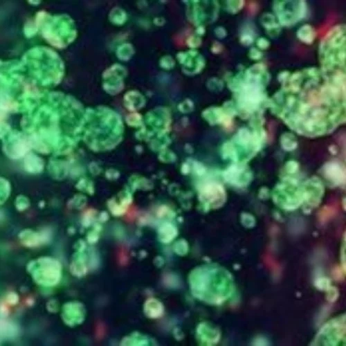 Τα σεξουαλικώς μεταδιδόμενα νοσήματα αυξάνονται ραγδαία στην Ευρώπη