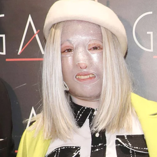 Ιωάννα Παλιοσπύρου | Η πρώτη φωτογραφία μετά το νέο χειρουργείο στο οποίο υποβλήθηκε