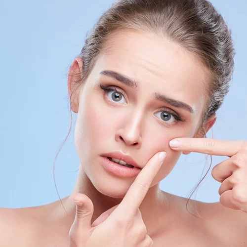 Έβγαλες ξαφνικά σπυράκια; Να τι μπορεί να φταίει