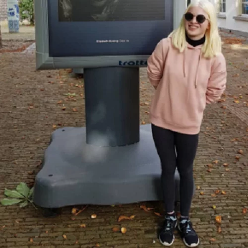 Γεννήθηκε με αλμπινισμό, εγκαταλείφθηκε όταν ήταν μωρό. Σήμερα είναι μοντέλο κορυφαίων brands