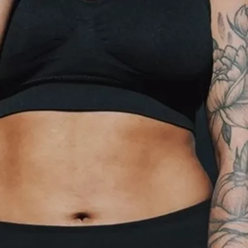 Πλαϊνά παχάκια | 4 συμβουλές για να τα εξαφανίσεις και να χτίσεις ένα πιο υγιές σώμα