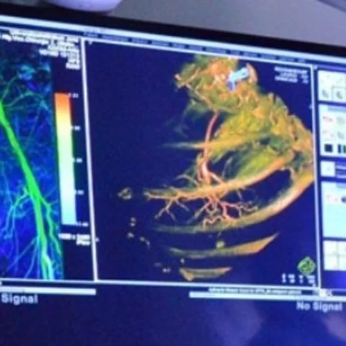 Μέθοδος εντοπισμού της γήρανσης των ανθρώπινων οργάνων προβλέπει τον κίνδυνο ασθενειών