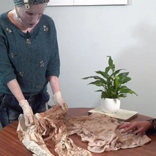 Συγκλονίζει η Ιωάννα Παλιοσπύρου | Δείχνει τα σημάδια και τα κατεστραμμένα ρούχα από την επίθεση με βιτριόλι [εικόνες - βίντεο]