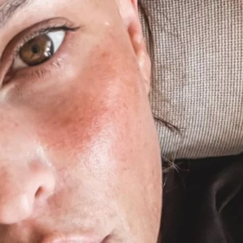 No make up | Η Σίσσυ Χρηστίδου μας δείχνει πώς είναι το πρόσωπό της χωρίς μακιγιάζ