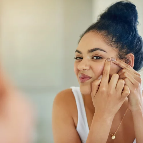 Αυτό είναι το μυστικό των μοντέλων με ακμή | Ακούγεται υπερβολικό, αλλά θα σώσει το δέρμα σου