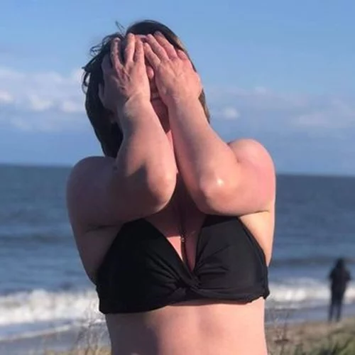 Γυναίκα με κολοστομία φοράει μπικίνι. Ετοιμάζεται να διασχίσει κολυμπώντας το Στενό της Μάγχης