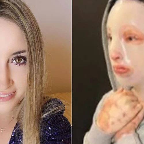 Ιωάννα Παλιοσπύρου | Το σχόλιο της Κατερίνας Καινούργιου κάτω από τη φωτογραφία της από το χειρουργείο