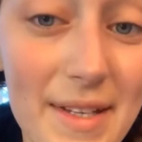 "Να τσεκάρετε το δέρμα σας" | Η ιστορία της 27χρονης Kassidy Pierson που πέθανε από μελάνωμα