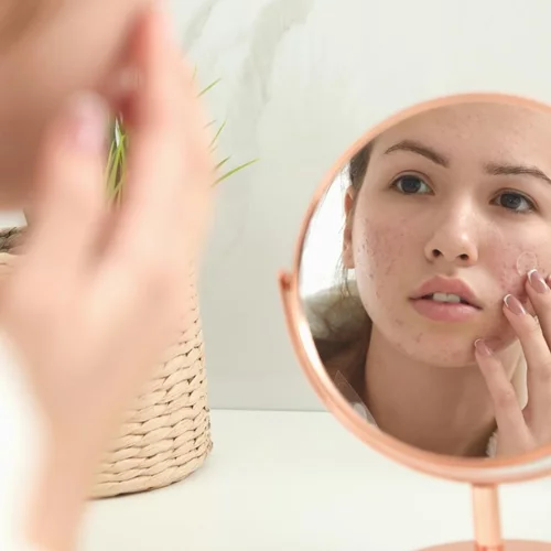 Glow up your skin | Τα καλύτερα προϊόντα περιποίησης για ευαίσθητες επιδερμίδες