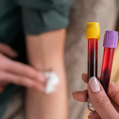 Καρκίνος στο πάγκρεας | Η απλή εξέταση που ανακάλυψαν οι επιστήμονες