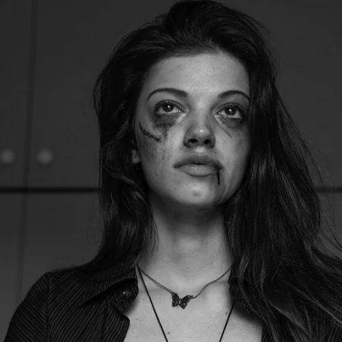 Τζένη Καζάκου | Ποζάρει χτυπημένη και κακοποιημένη - Το δημόσιο μήνυμα