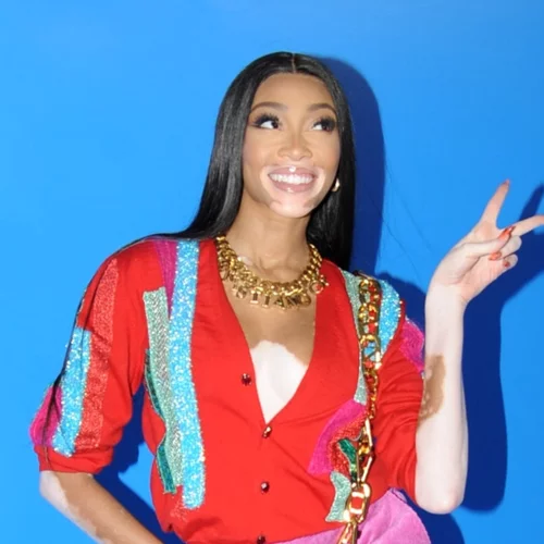 Το καλοκαίρι φοράμε χρώματα αλλά καλό είναι να αποφύγεις αυτούς τους 3 συνδυασμούς