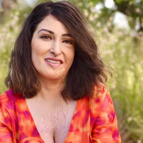 Ιωάννα Παλιοσπύρου | "Με πειράζει που έχω παντού ουλές και µοσχεύµατα, βιώνω δύσκολες στιγµές"