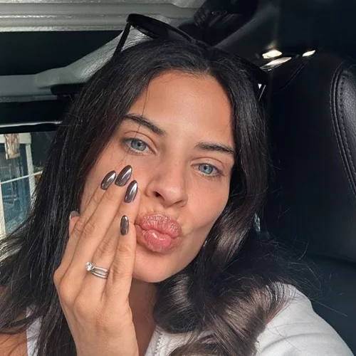 Χριστίνα Μπόμπα | Δείχνει τα σημάδια στο πρόσωπό της που είναι κληρονομικά