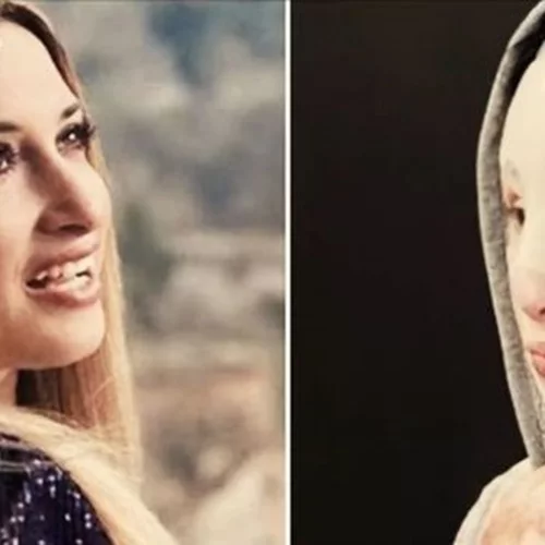 Η Ιωάννα δείχνει για πρώτη φορά το χέρι της μετά την επίθεση με το βιτριόλι: "Είναι μαχήτρια"