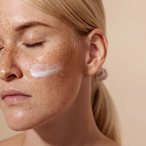 Οι 5 καλύτερες κρέμες για σημάδια ακμής που θα βρεις στο φαρμακείο της γειτονιάς σου