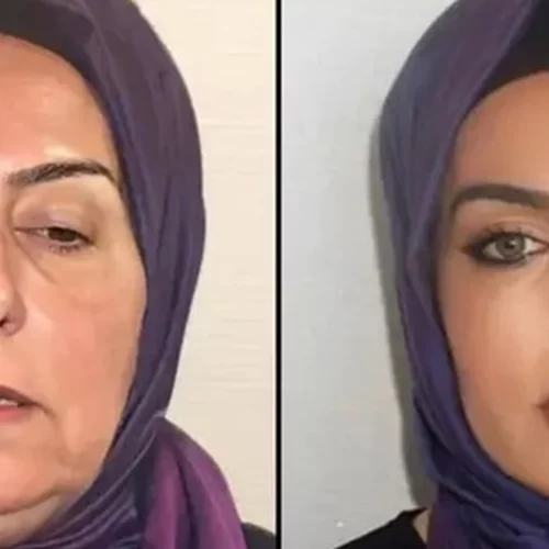 H ολική μεταμόρφωση της 68χρονης Ντιλέκ