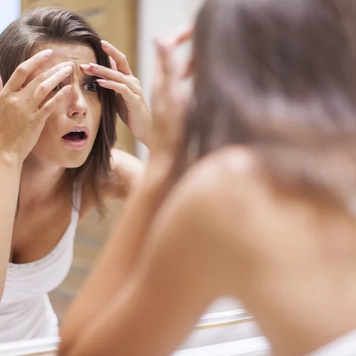 Tα 5 SOS beauty τρικς της τελευταίας στιγμής | Το ενοχλητικό σπυράκι και άλλα