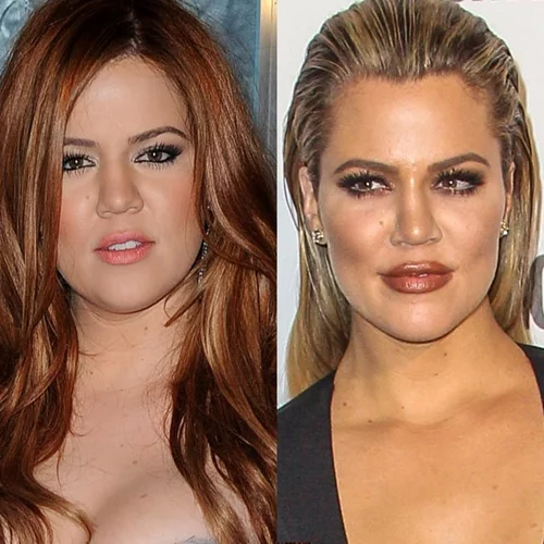 Πώς ήταν και πώς έγινε | Η Khloe Kardashian και η τεράστια μεταμόρφωσή της