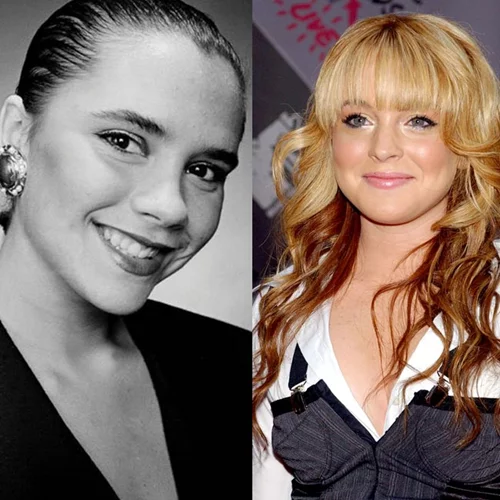 Πριν και μετά τις πλαστικές: Οι επώνυμοι που πλέον τρομάζουμε να αναγνωρίσουμε!