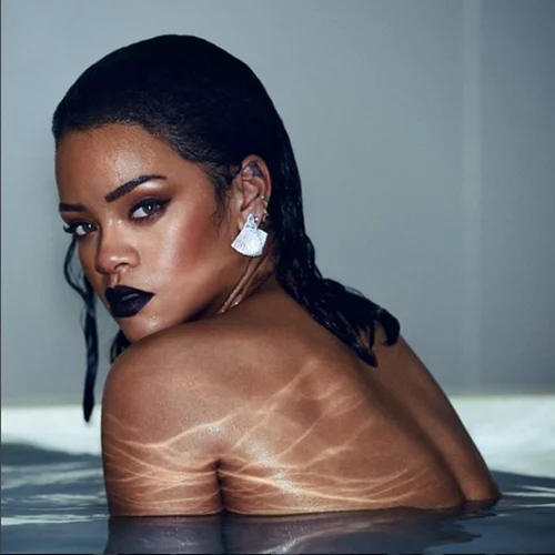 Η Rihanna ακύρωσε την εμφάνισή της στα Grammys