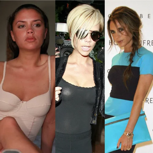 Το στήθος της Victoria Beckham έχει τη δική του προσωπικότητα και εξέλιξη στο χρόνο