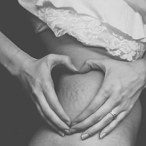 Το Instagram account για αληθινές γυναίκες! (έχεις ραγάδες; μπράβο!)