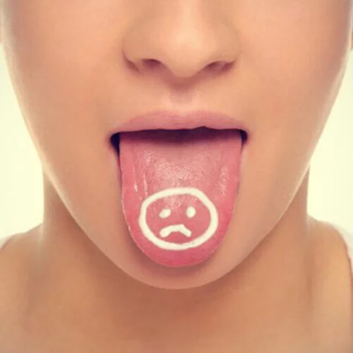 Ο καρκίνος του στόματος "προτιμά" τους νέους