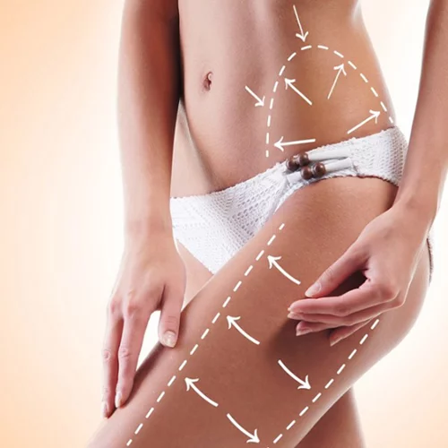 Τι είναι η κυτταρίτιδα και πώς θα την νικήσεις με διατροφή