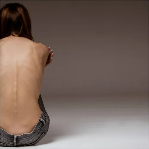 Ανάλυσέ Το: Τι είναι η νευρική ανορεξία και πώς να προστατέψεις το παιδί σου από αυτή