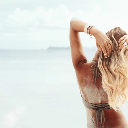 Έγκαυμα από τον ήλιο: 5 + 1 tips για να το αντιμετωπίσεις άμεσα