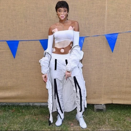 Winnie Harlow: Μαζί με τον Lewis Hamilton στη Μύκονο