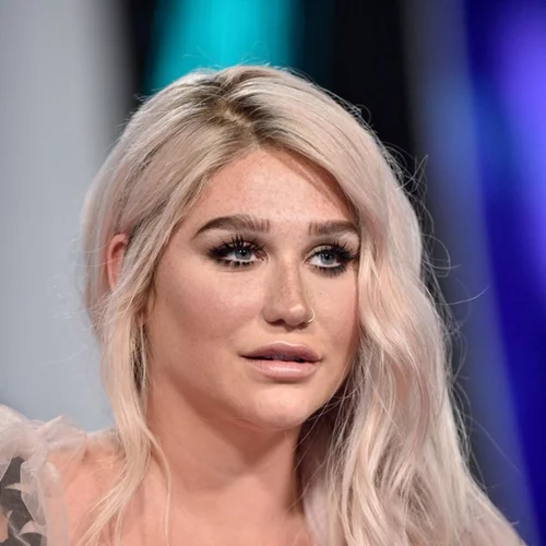 Η απλή selfie της Kesha ρίχνει το Twitter γι' αυτό τον λόγο...