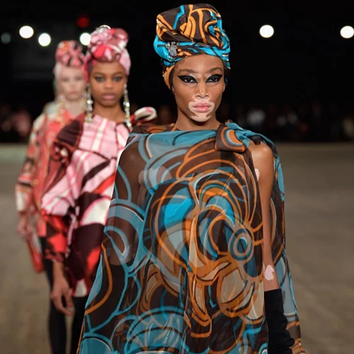 Winnie Harlow: Κι όμως δεν ήθελε να γίνει μοντέλο!