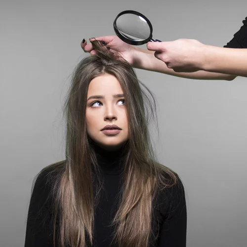 Πιτυρίδα: Μην την βλέπεις σαν εχθρό, μάθε πώς θα την αντιμετωπίσεις αποτελεσματικά