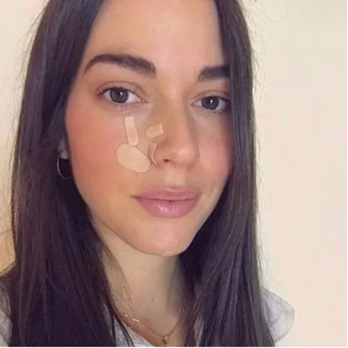 Ισμήνη Νταφοπούλου: Πιο όμορφη από ποτέ μετά τον σοβαρό τραυματισμό στο πρόσωπο!