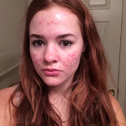 Φωτογράφιζε την ακμή της και έγινε viral!