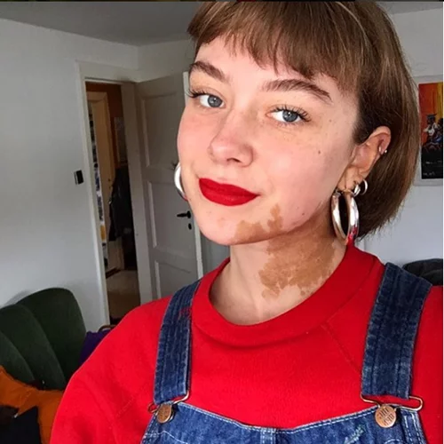 Αυτή η κοπέλα κάλυψε το σημάδι της στο πρόσωπό της με τον πιο τέλειο τρόπο που την έκανε να το αγαπήσει