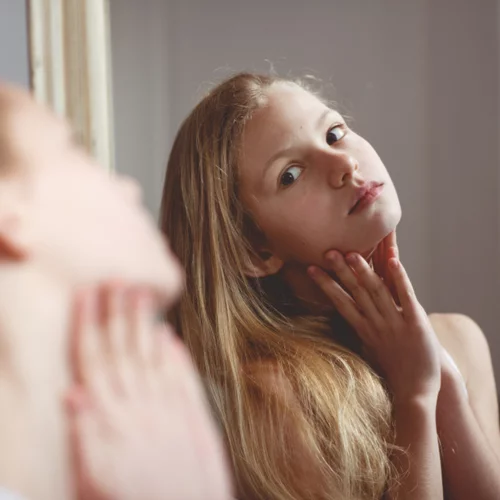 #Freethepimple | Ένα νέο κίνημα στο Instagram θα σε κάνει να αγαπήσεις την ακμή σου