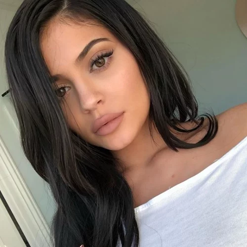 Kylie Jenner | Αυτός είναι ο λόγος που αποφάσισε να αφαιρέσει τα εμφυτεύματα χειλιών